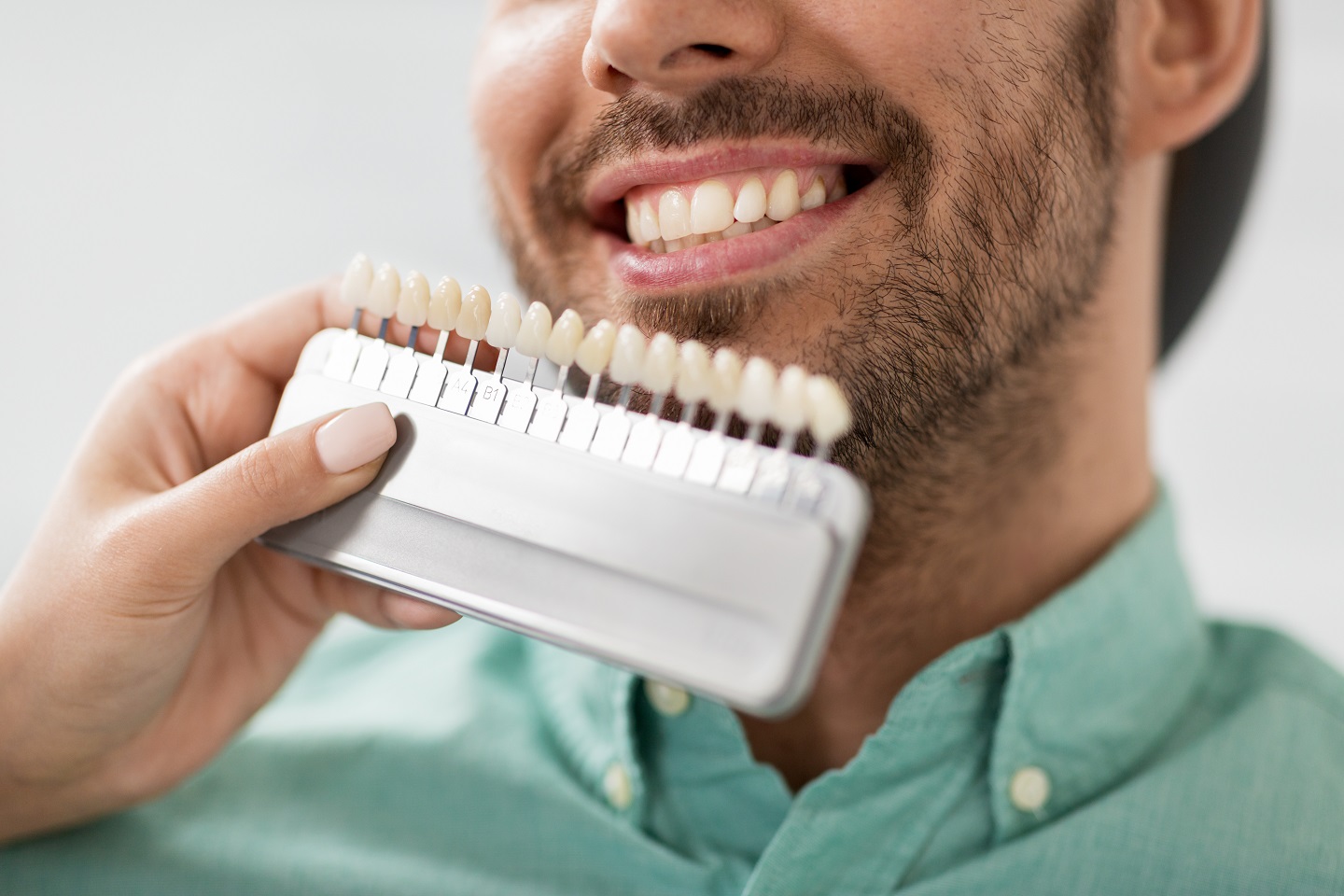 When It’s Time to Replace Your Veneers When It's Time to Replace Your Veneers