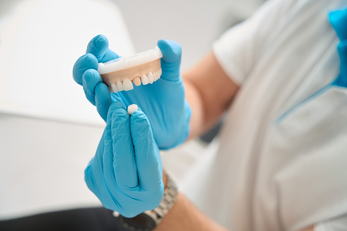Transform Your Smile with Porcelain Crowns Transform Your Smile with Porcelain Crowns