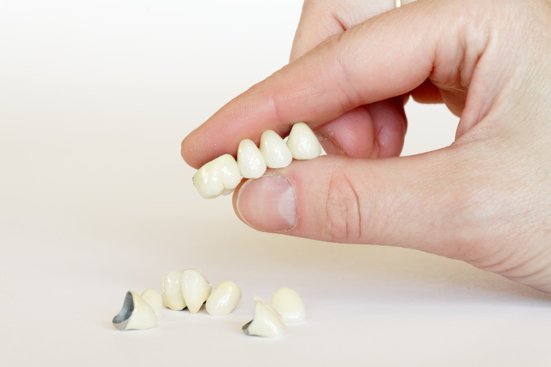 Same-Day Dental Crowns: CEREC Technology in Sedona