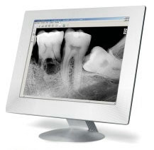 Advanced Dental Technology used by a top rated Sedona, AZ dentist, digital x-rays are used to reduce radiation to our patients.